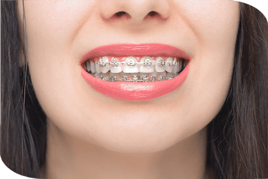 Orthodontics